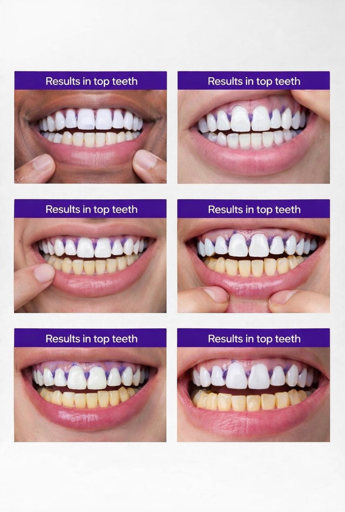 LumiSmile Whitening Strips