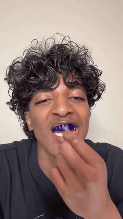 LumiSmile Whitening Strips