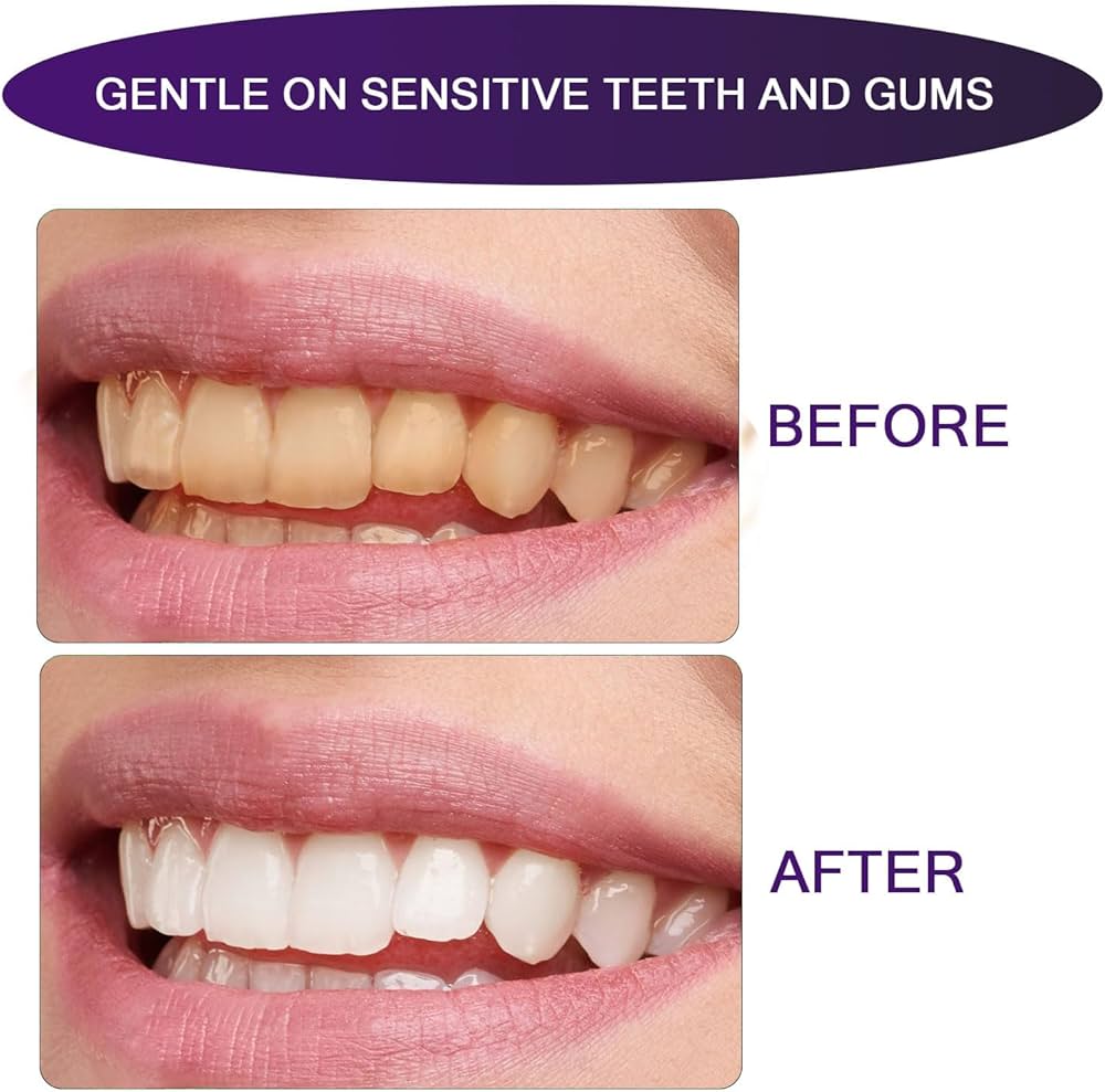 LumiSmile Whitening Strips