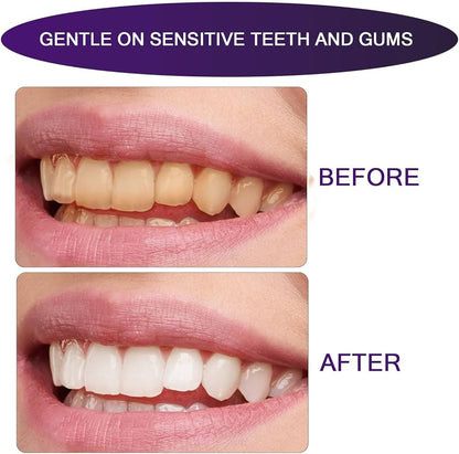LumiSmile Whitening Strips