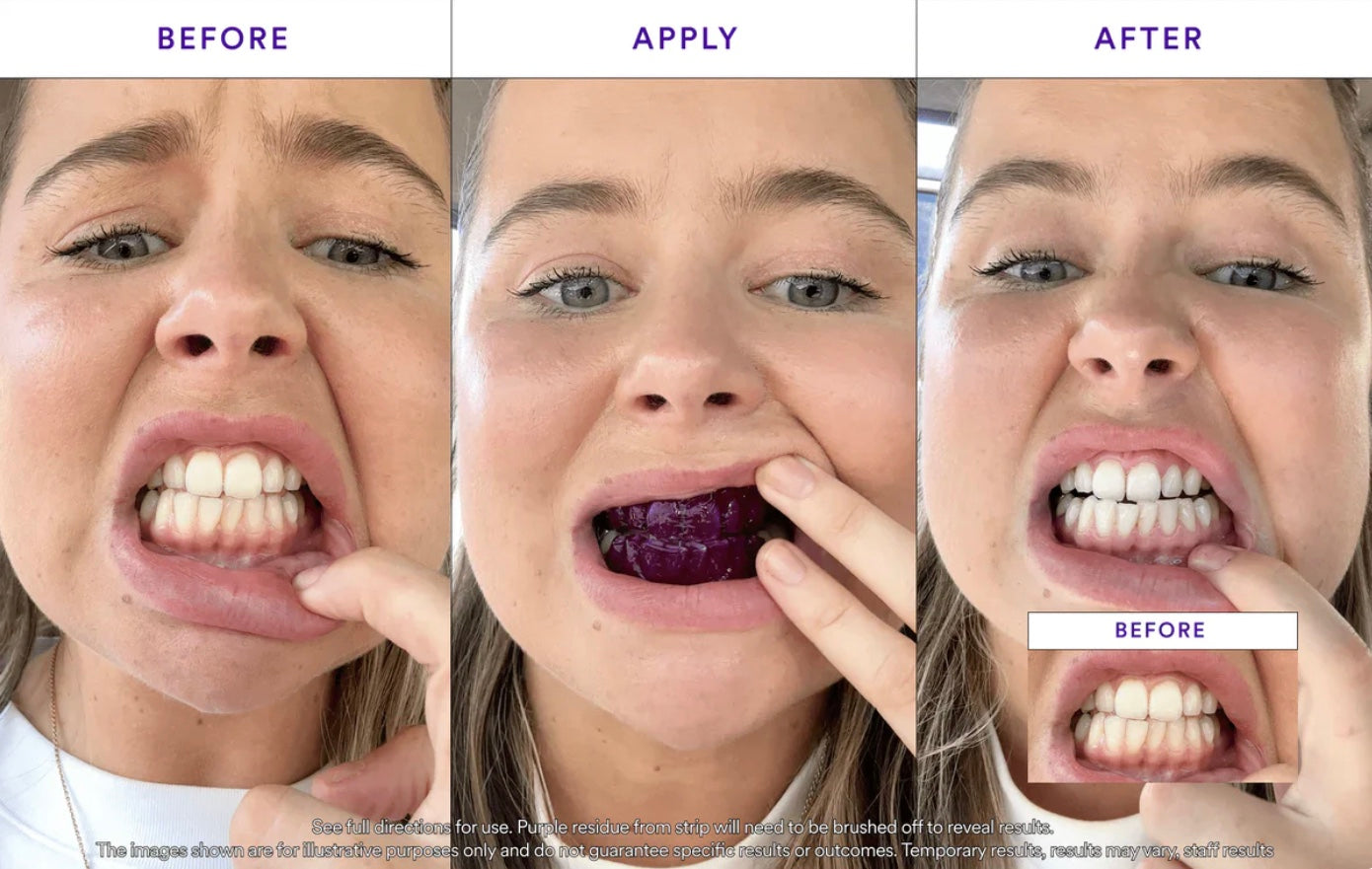 LumiSmile Whitening Strips