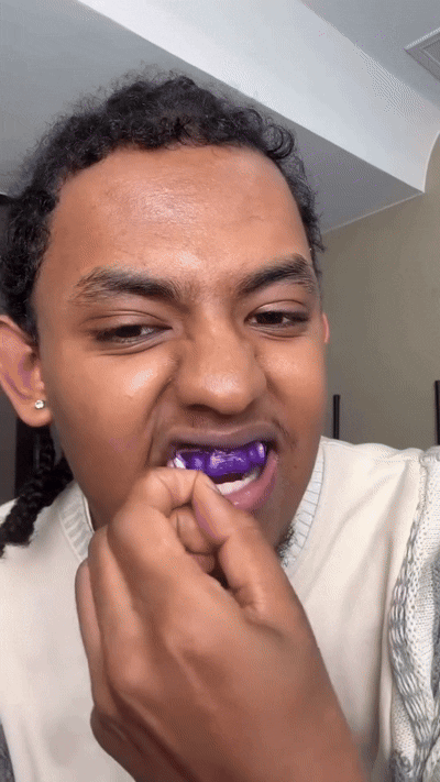 LumiSmile Whitening Strips