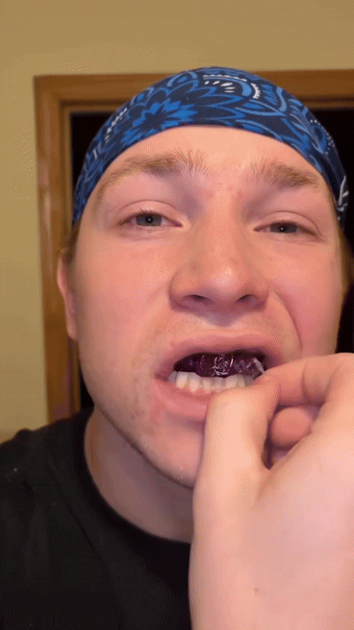 LumiSmile Whitening Strips